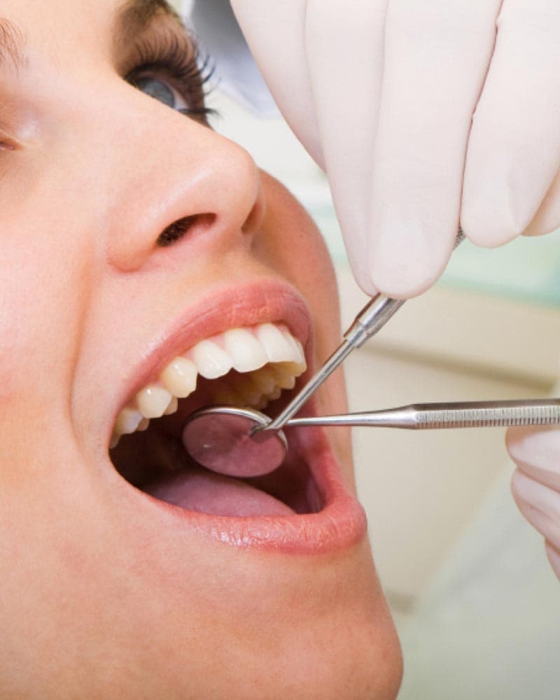 Root Canal Treatment